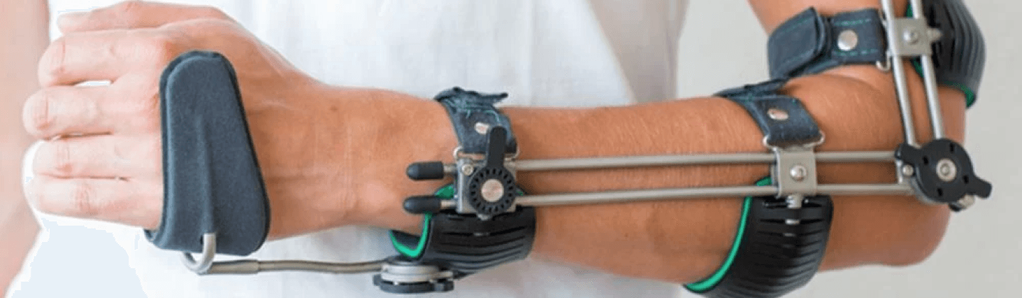 Upper Limb