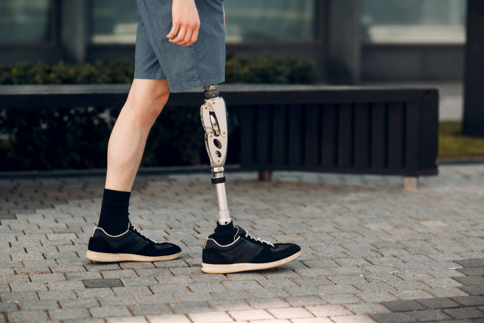 Lower limb prosthesis fitted at Qudra